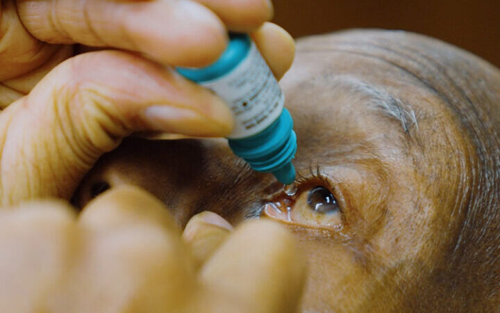 Treating Glaucoma With Medication