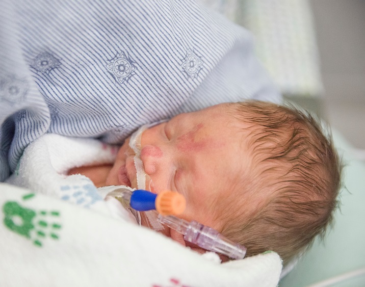 Retinopathy of Prematurity (ROP)